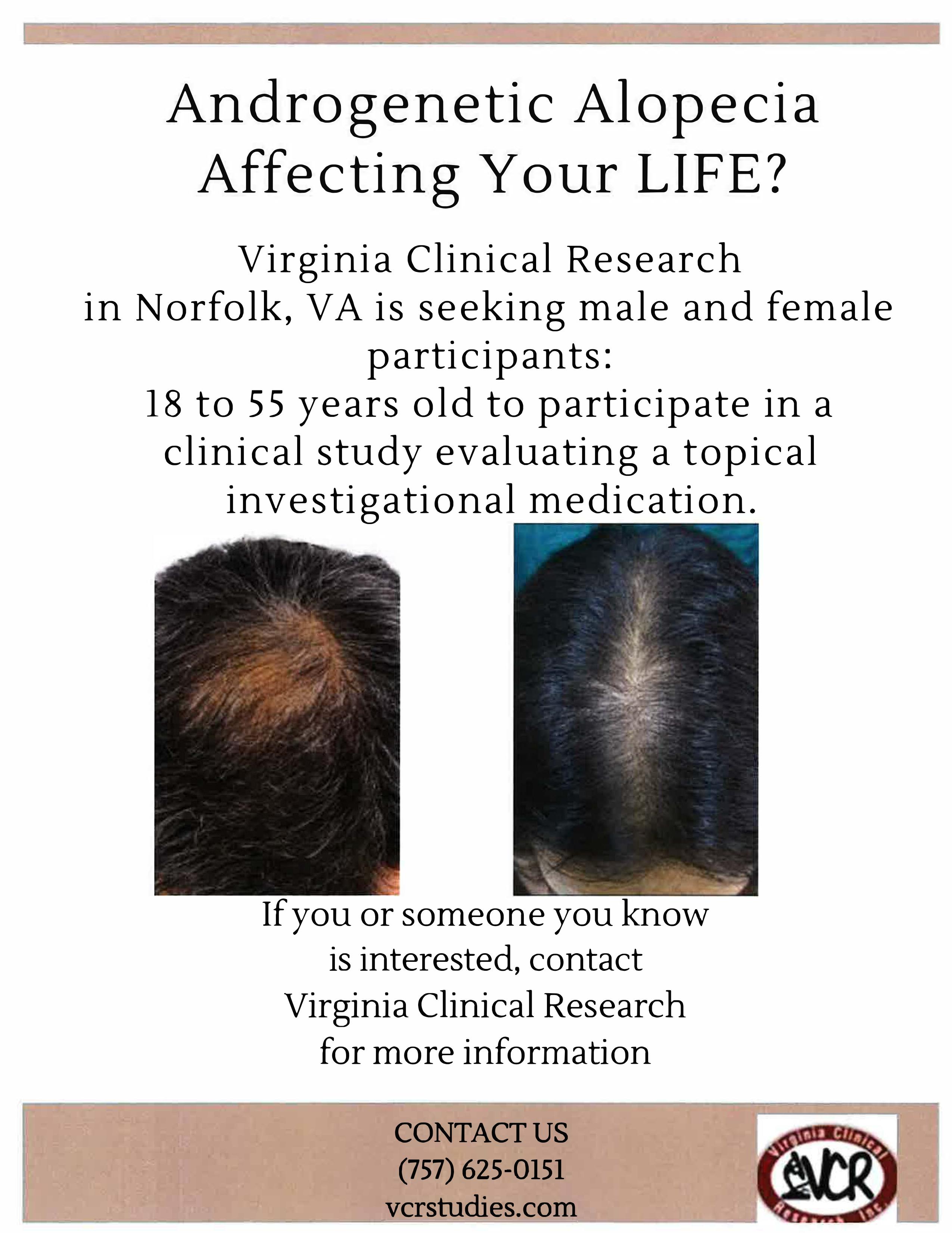 Androgenic Alopecia 